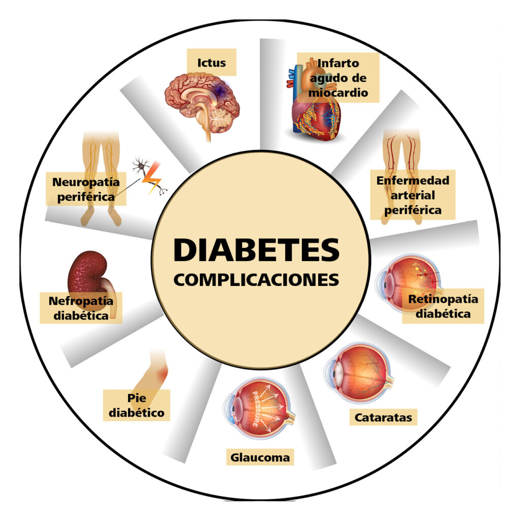 Todo sobre… la diabetes - Endocrinología