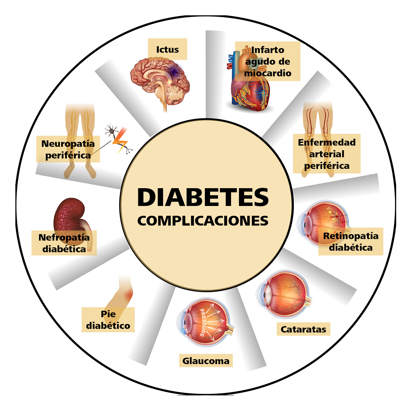 Diabetes Síntomas y causas Mayo Clinic